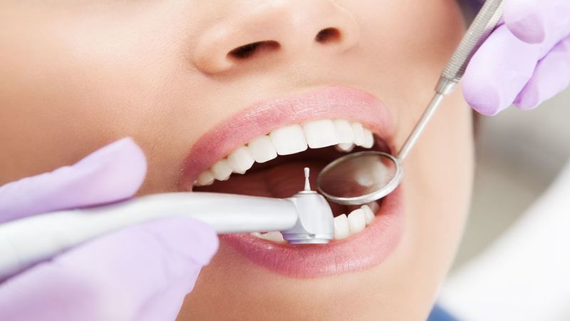 Why You Need to Schedule an Impacted Teeth Removal in Florence, AZ