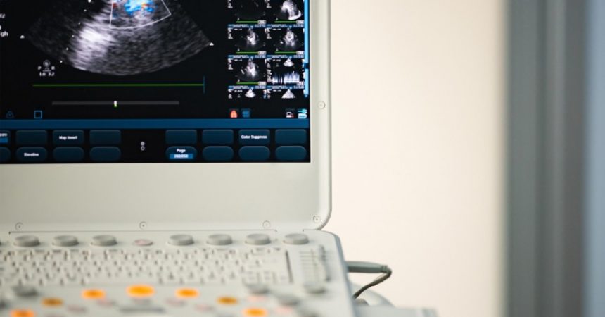 A Few Things You Should Know When Buying an Ultrasound Machine