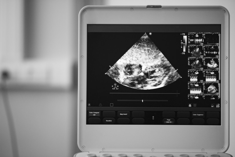 A Comparison Of Ge Logiq E9 And Sonosite Ultrasound Machines