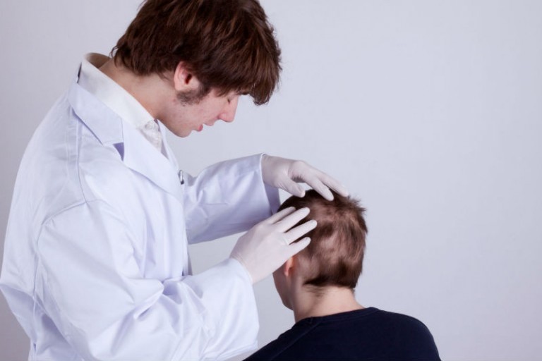 Things to Know When Considering a Hair Transplant in Washington, DC