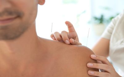 Exploring the benefits of Acupuncture therapy in Newark, CA