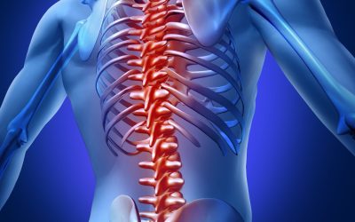 Understanding Sacroiliitis: Relief Options in Springs, AR Explained