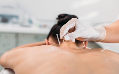 Finding Lasting Relief With Acupuncture For Pain Newark, CA Residents Can Trust