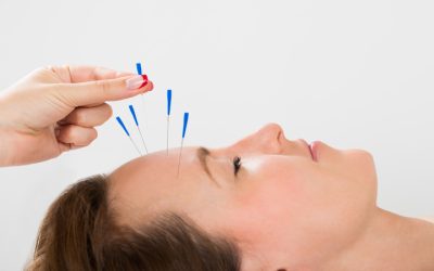 Relieve Chronic Pain and Stress with Acupuncture Treatment, Berkeley, CA Experts Recommend