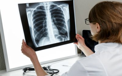 Find Relief From Respiratory Issues With a Pulmonary Physician in Murrieta, CA Care